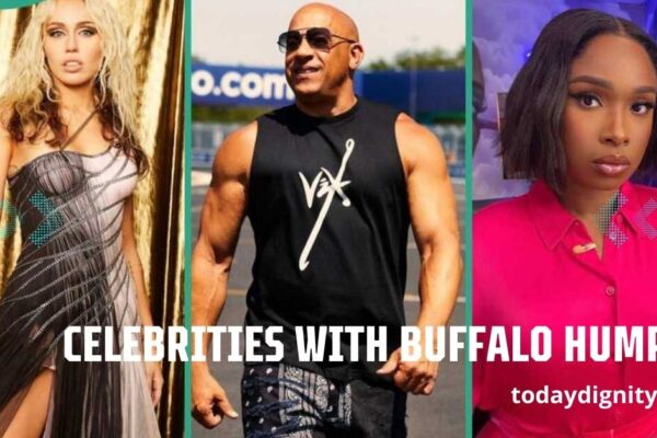 Celebrities with Buffalo Hump